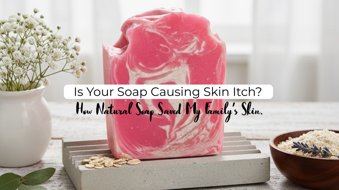 Is Your Soap Causing Skin Itch? How Natural Soap Saved My Family’s Skin.